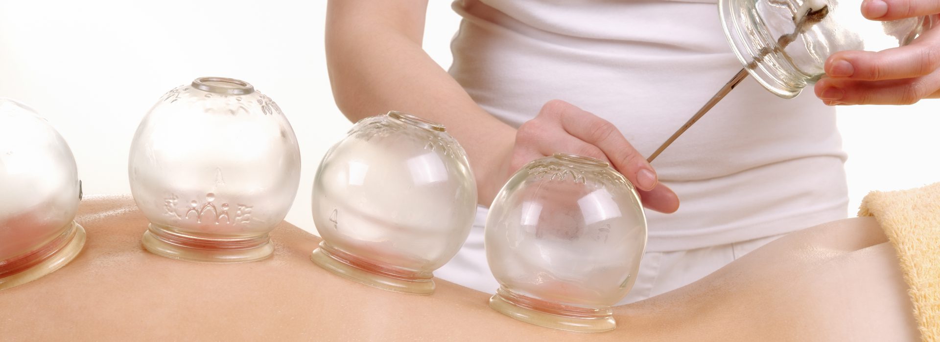 Cupping ter verbetering van je gezondheid. 